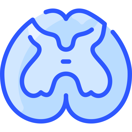 Spinal Cord Stimulation (Paddle Lead) Dr. Mohit Anand